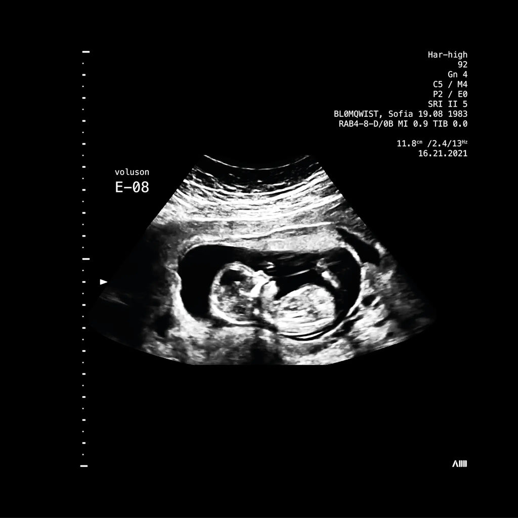 détail d'une échographie sonogram