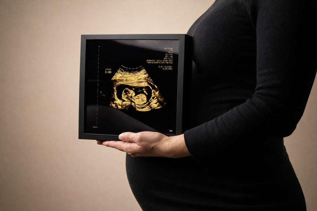 une femme qui tient un sonogram dans sa main