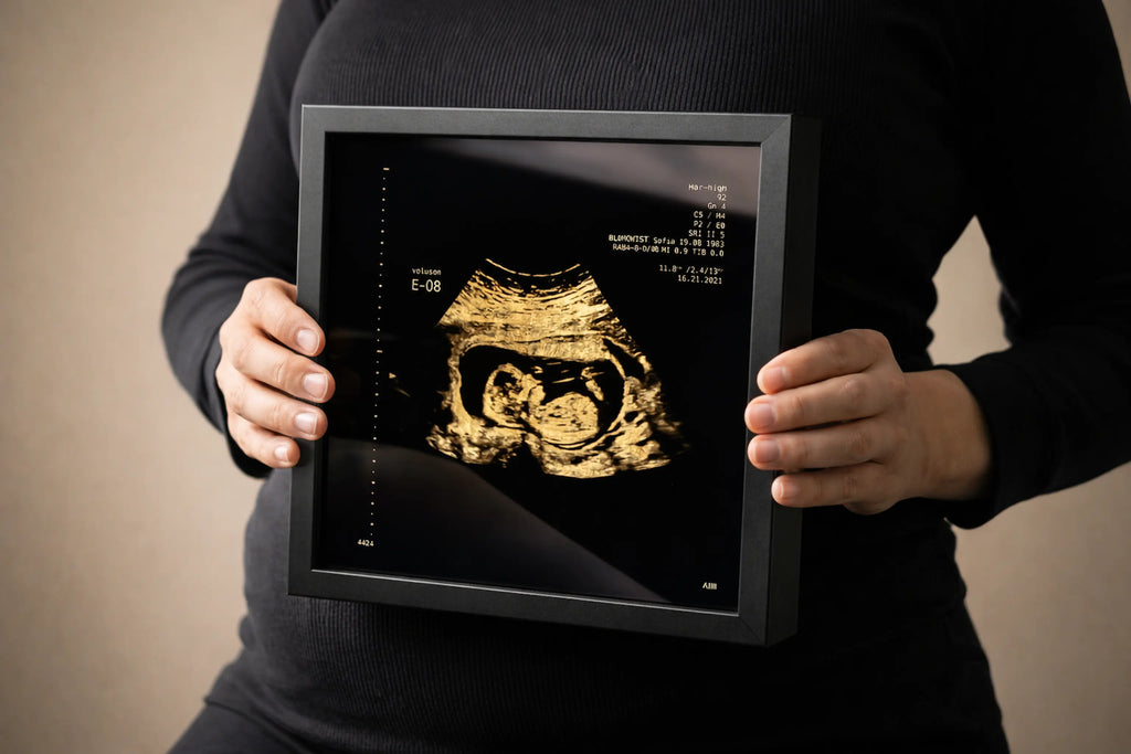 une femme qui montre un sonogram gold