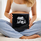 une femme assise en tailleur qui tient un sonogram argent 