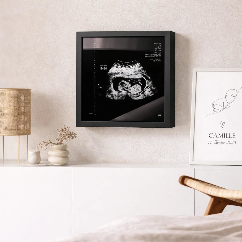 photo d'un cadre Sonogram argent