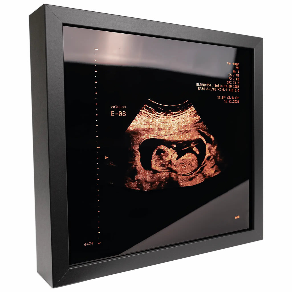 photo d'un cadre Sonogram cuivre
