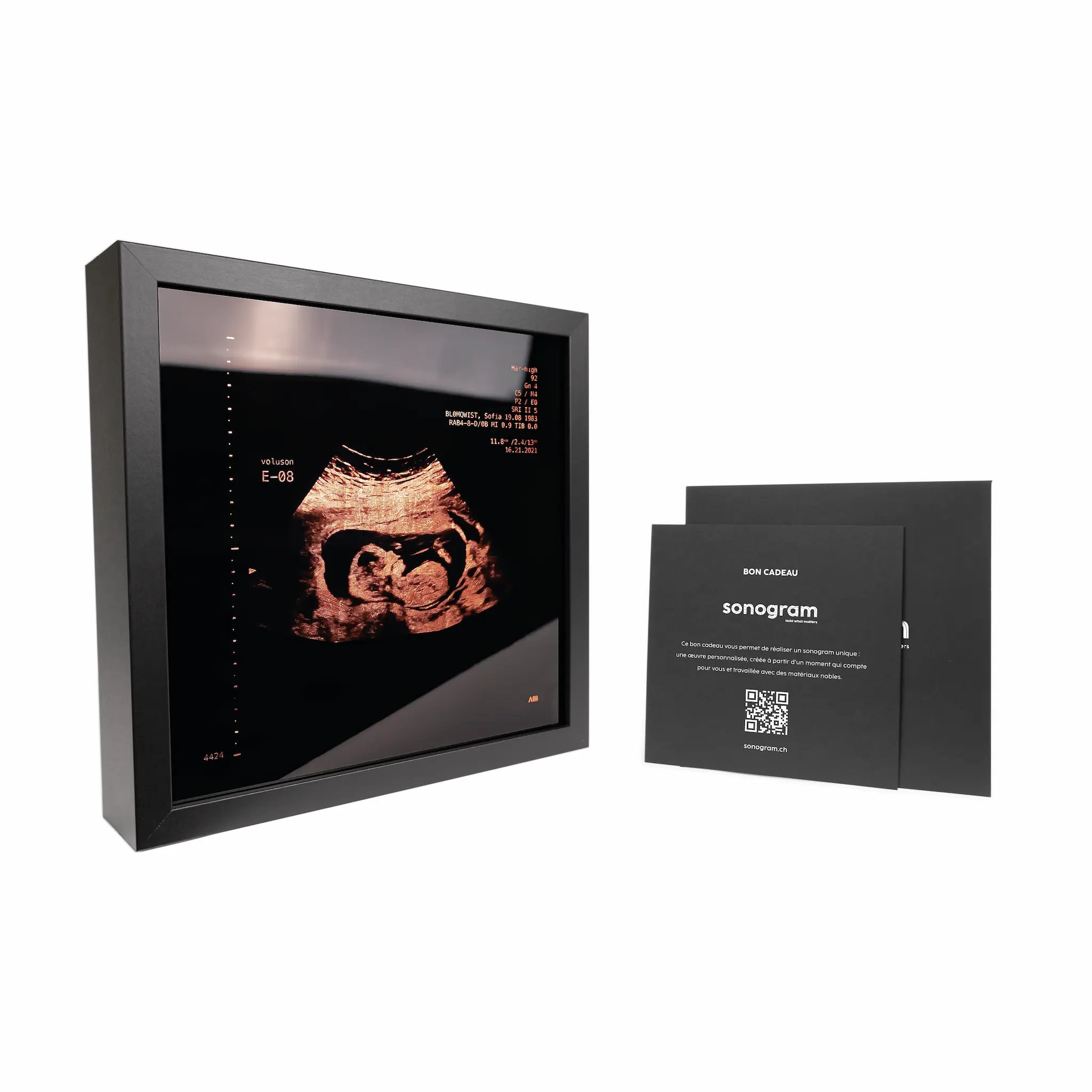 photo d'un cadre Sonogram cuivre