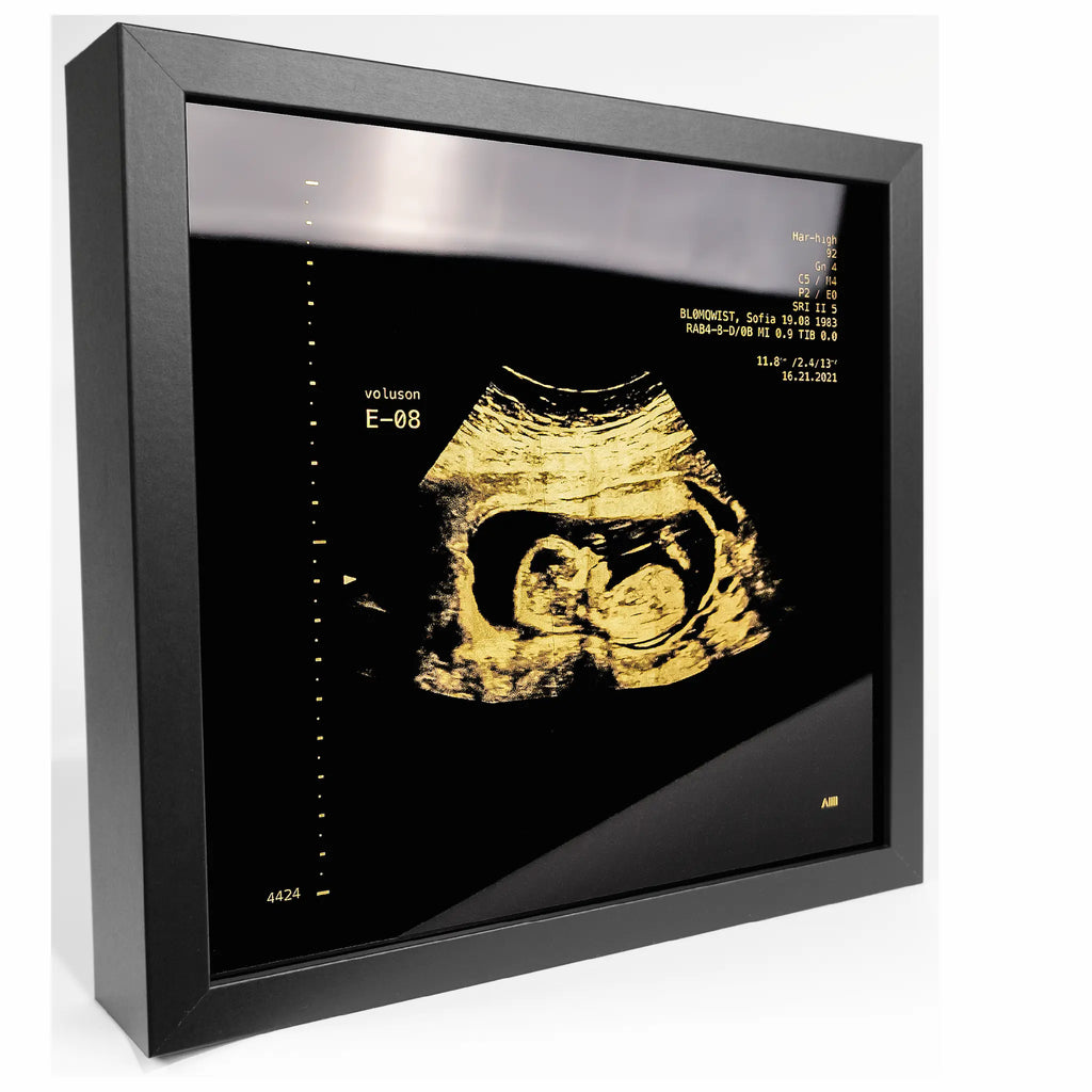 photo d'un cadre Sonogram goldd