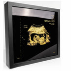 photo d'un cadre Sonogram goldd