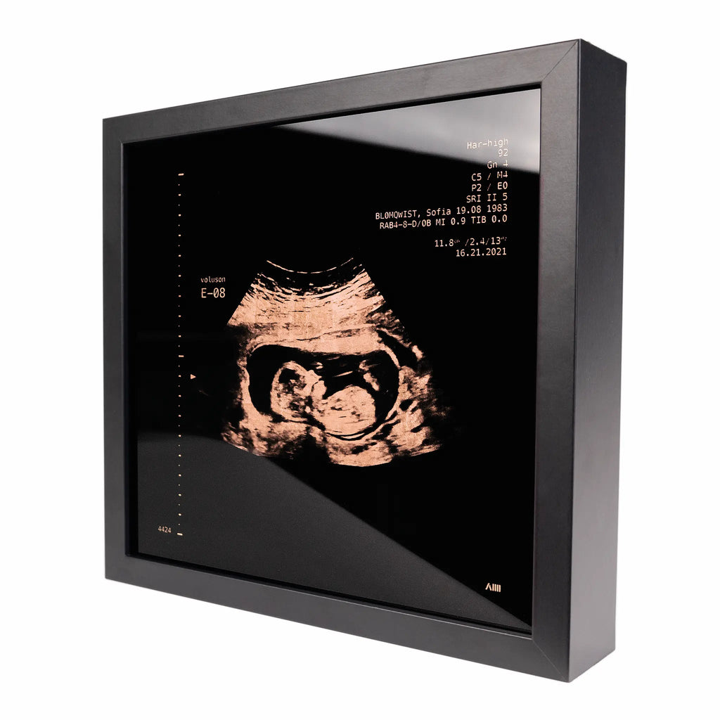 photo d'un cadre Sonogram or rose
