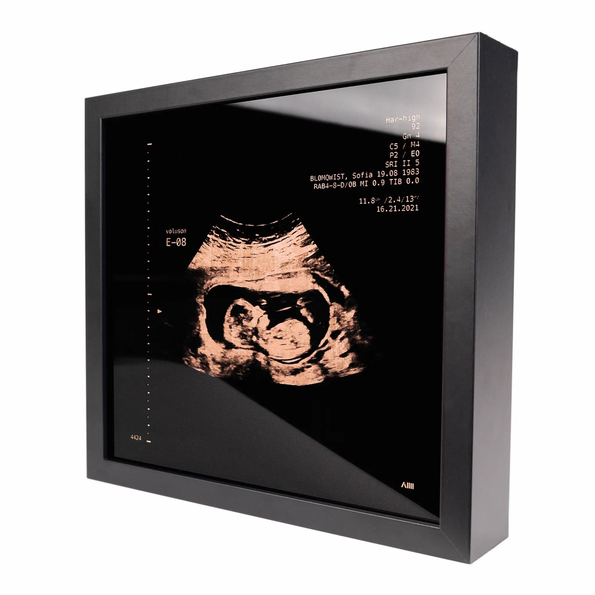 photo d'un cadre Sonogram or rose