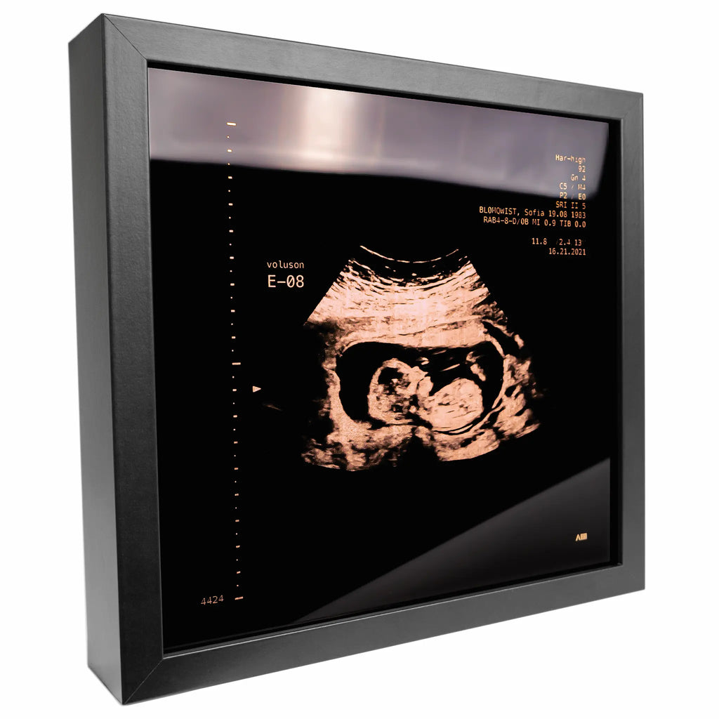photo d'un cadre Sonogram or rose
