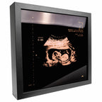 photo d'un cadre Sonogram or rose