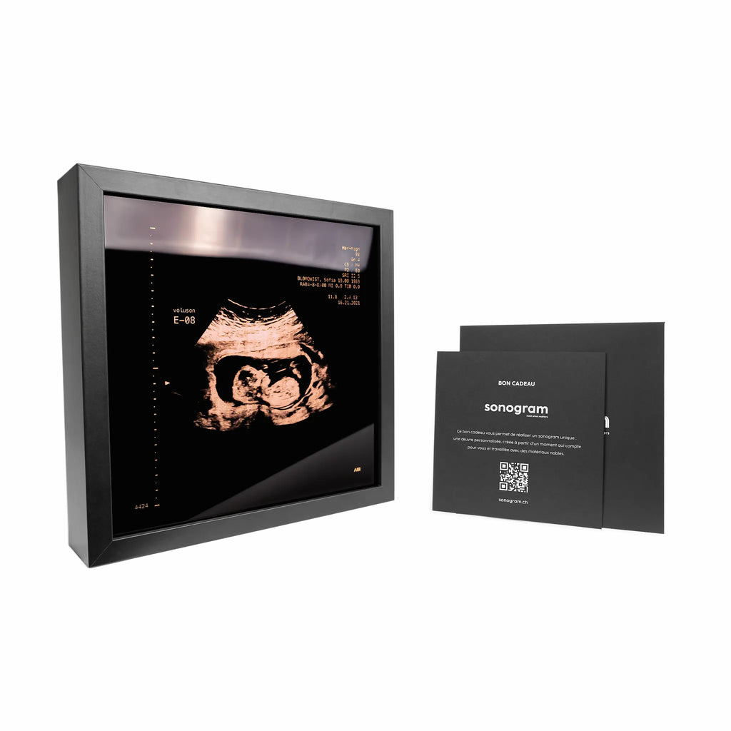 photo d'un cadre Sonogram or rose