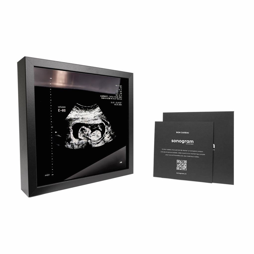 photo d'un cadre Sonogram argent