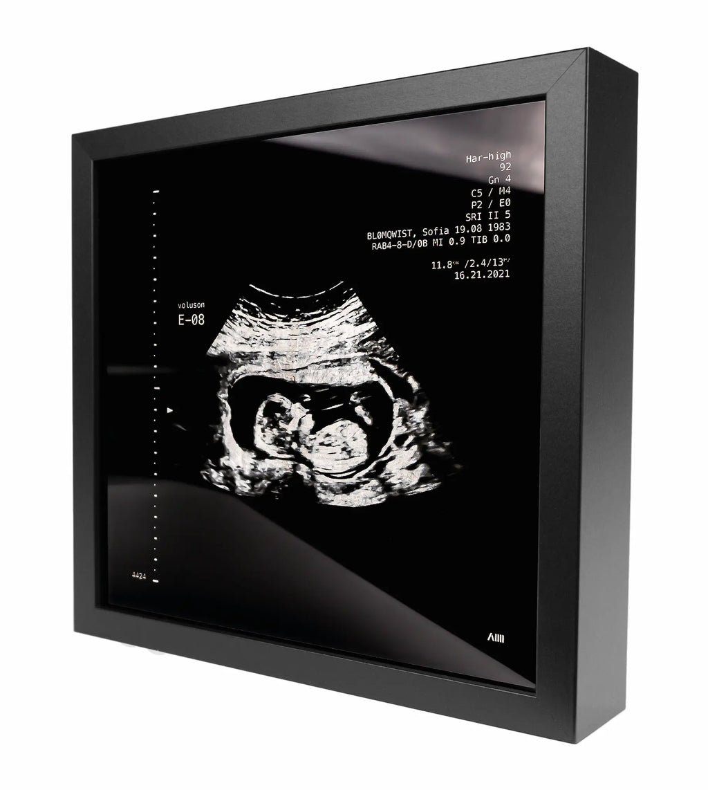 photo d'un cadre Sonogram argent