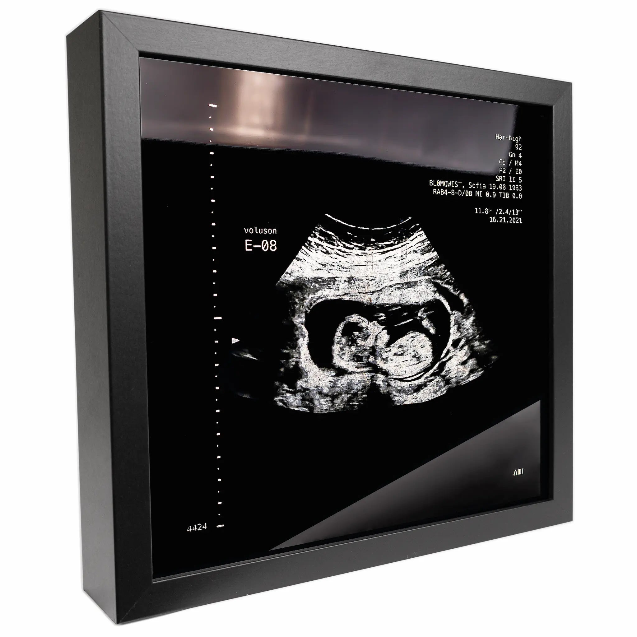 photo d'un cadre Sonogram argent