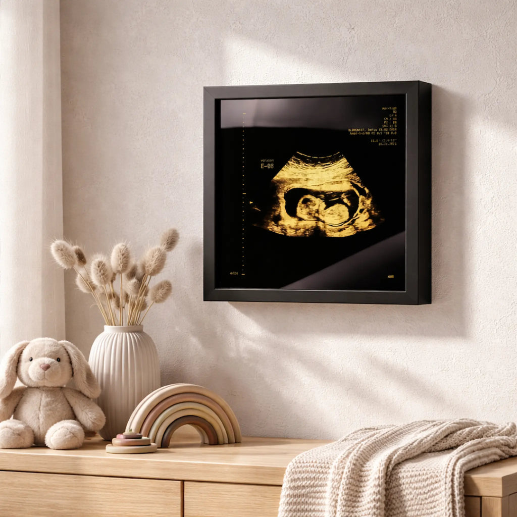 un cafre sonogram or accroché dans une chambre d'enfant